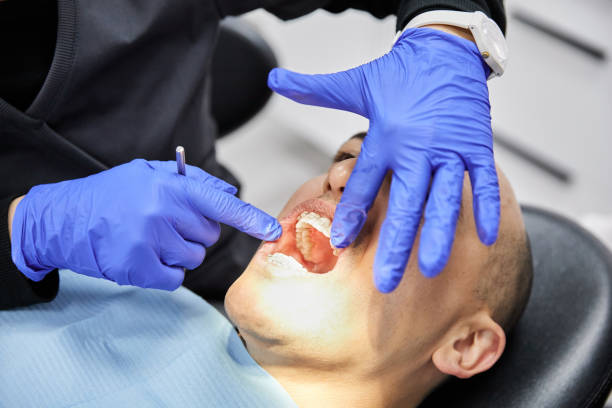 Best Emergency Wisdom Teeth Removal in Vancleave, MS