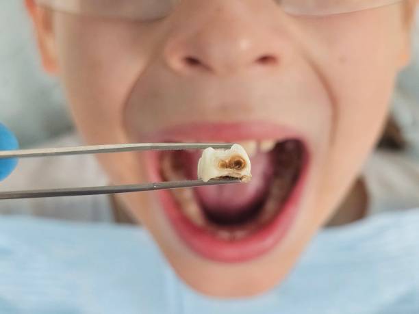 Best Pediatric Emergency Dentist in Vancleave, MS