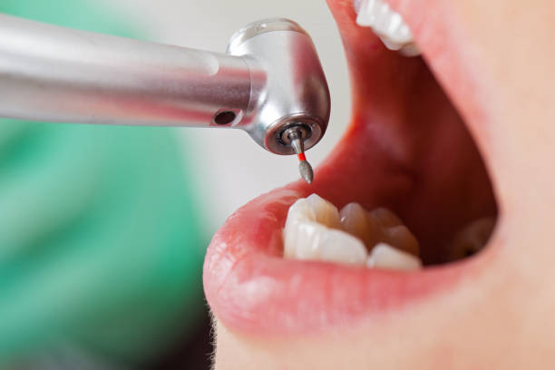 Best Cosmetic Emergency Dentistry in Vancleave, MS